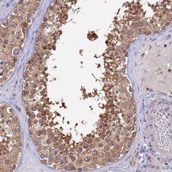 Karyopherin (importin) beta 3 Antibody, Novus Biologicals:Antibodies:Primary